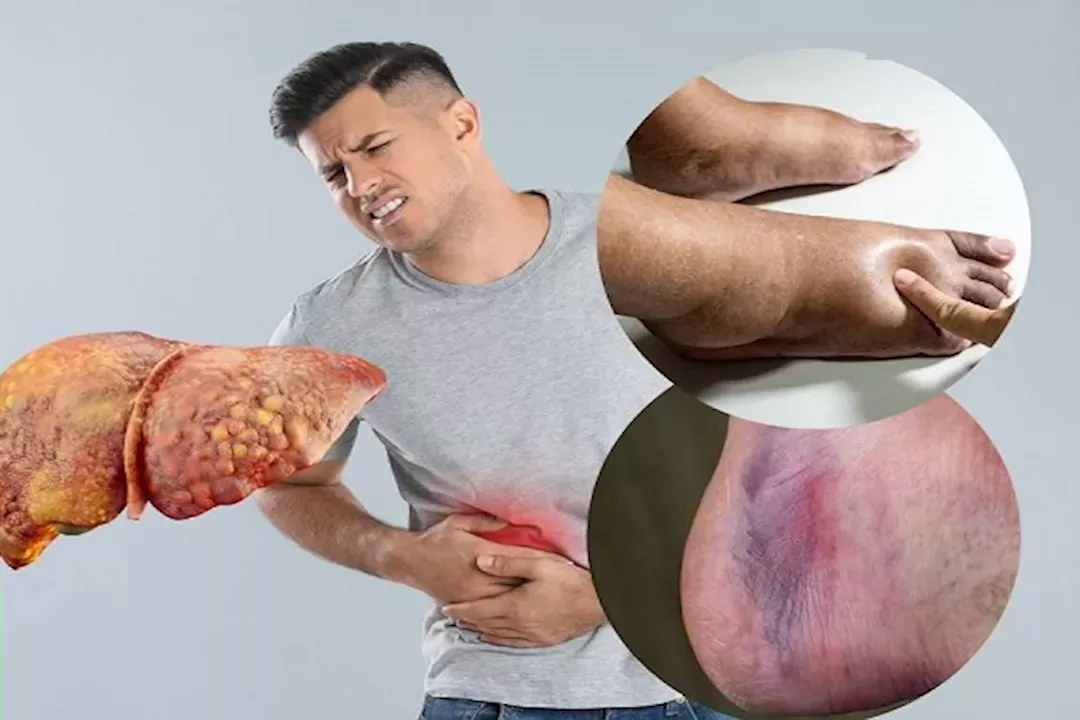 الكبد