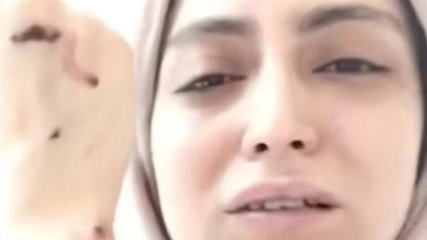 طبيبة الأسنان المعتدى عليها
